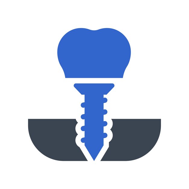 Dental Implants & Teeth Replacement