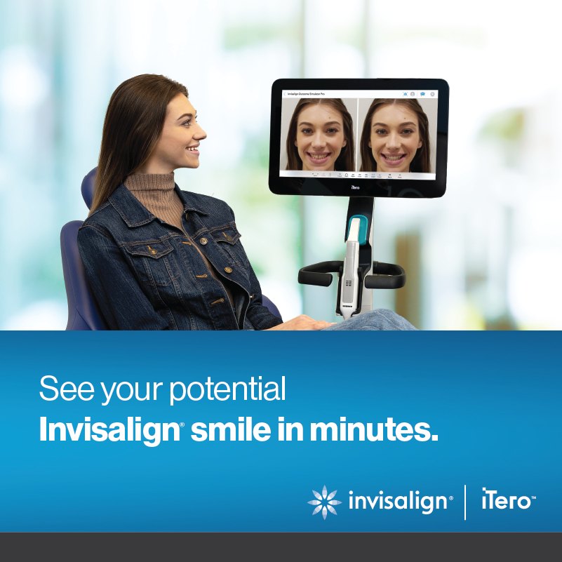 A woman in a dental chair looking at a before-and-after smile simulation on an iTero scanner screen. Banner text: See your potential Invisalign smile in minutes. Invisalign and iTero logos.